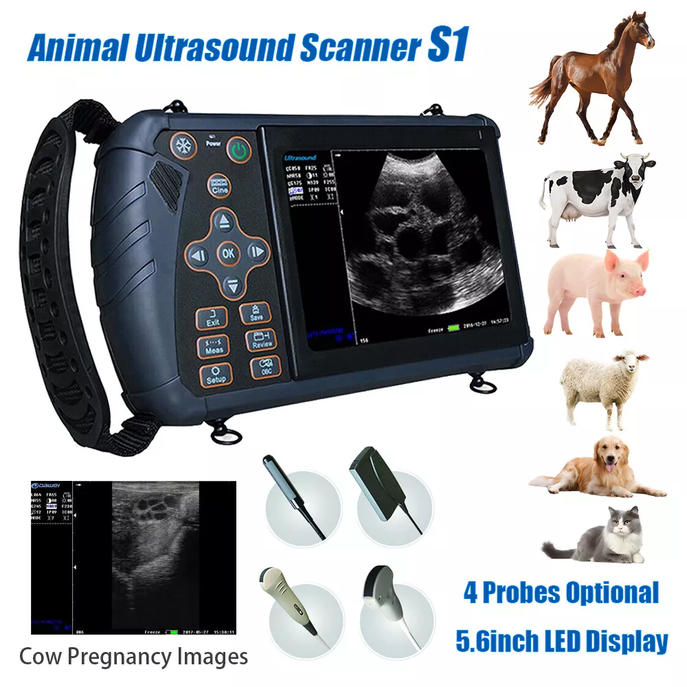 Φορητός υπέρηχος εγκυμοσύνης